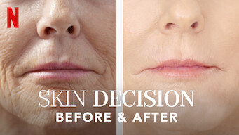 Skin Decision: Before and After (2020)